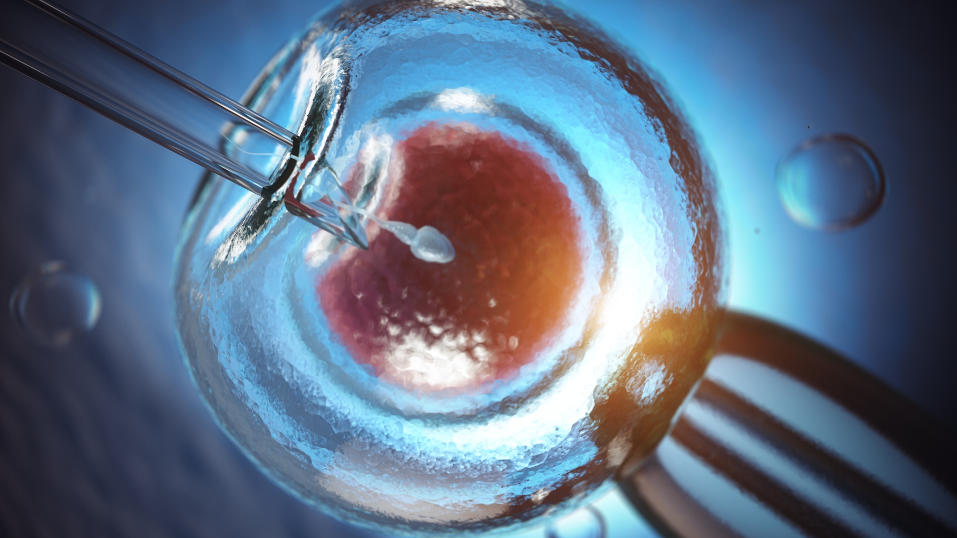 Microinjeção de espermatozoide em óvulo durante procedimento de fertilização in vitro avançada em laboratório.